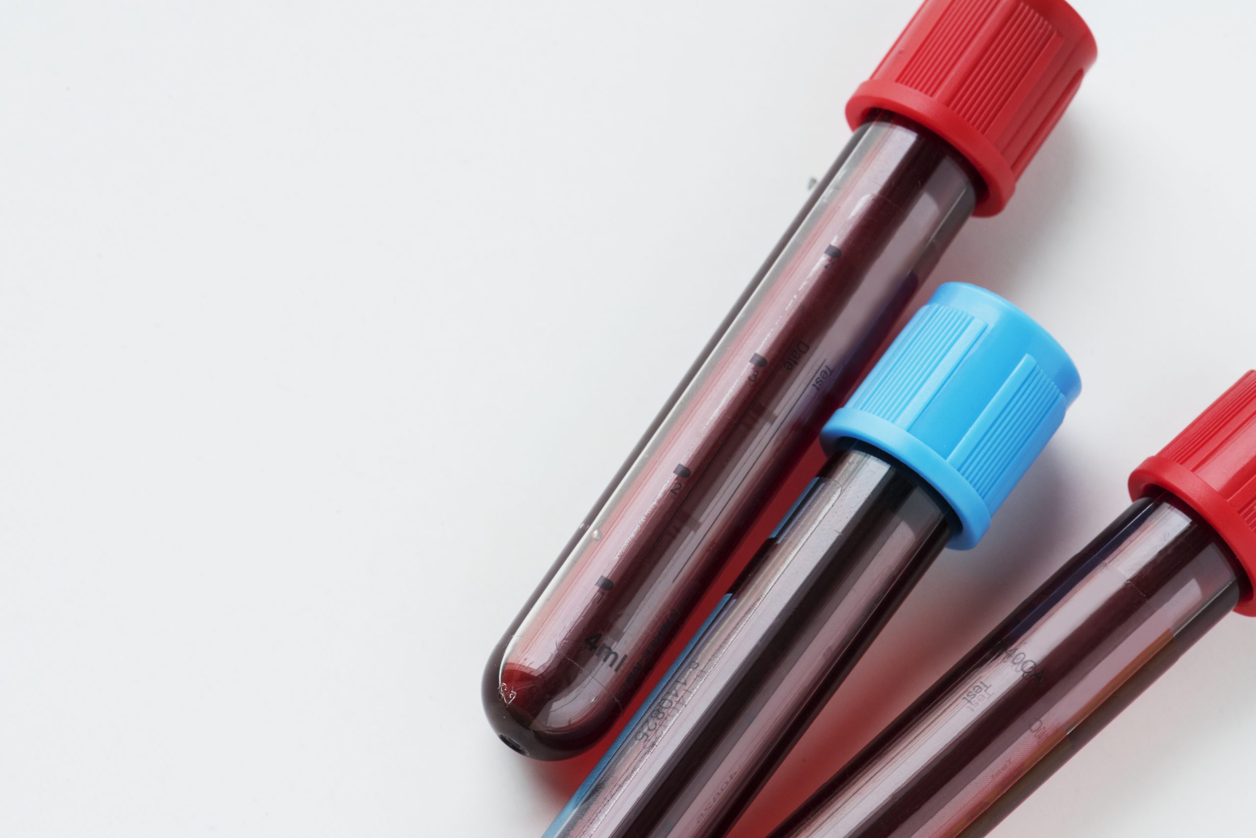 blood sample tubes