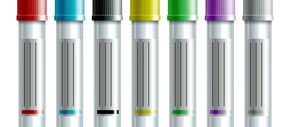 different color test tubes